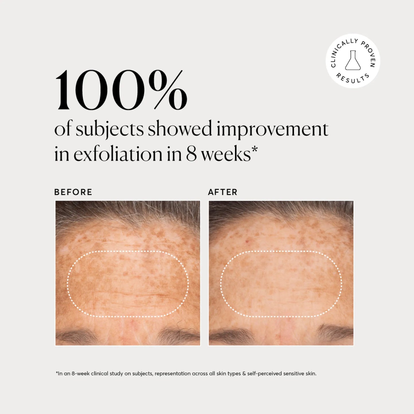 bha-liquid-exfoliant-2-y3 NATR-10027-Alt-Images-BHA-Liquid-Exfoliant-2_-03.webp